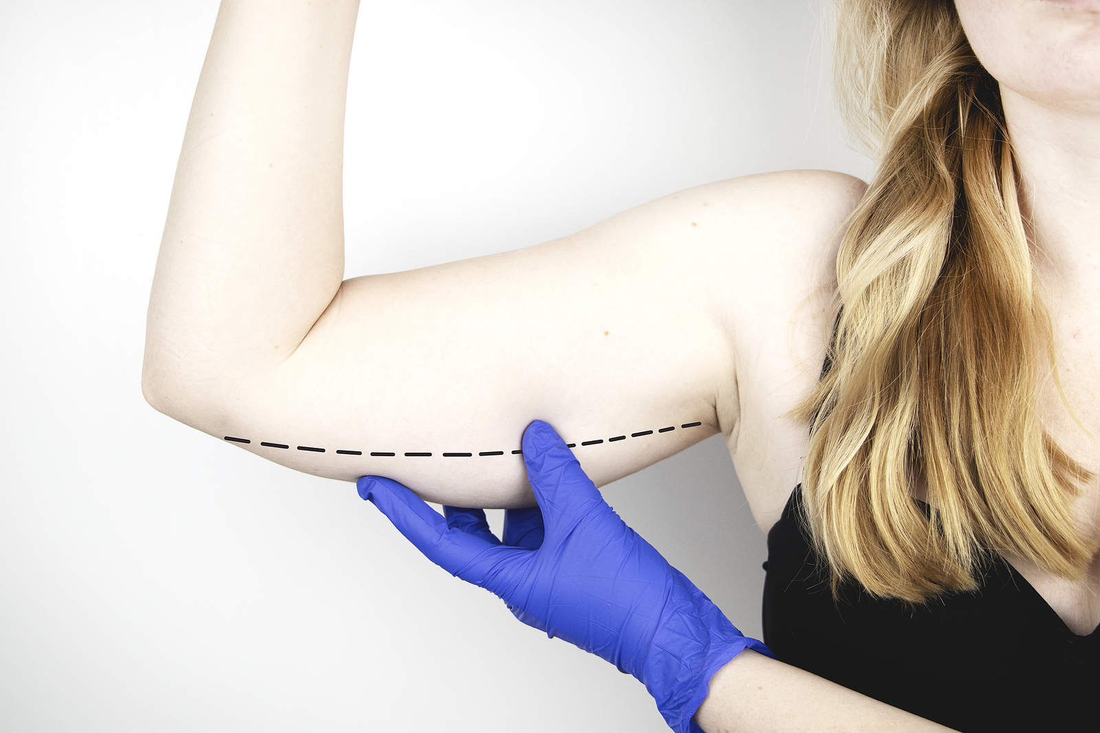 Eliminate Stubborn Fat in Denver, CO Eliminate Stubborn Fat in Denver, CO