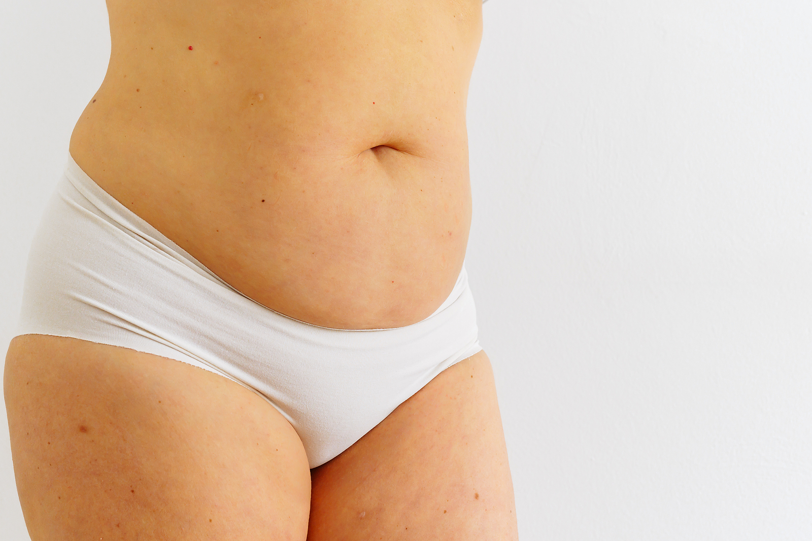 Sagging Abdominal Skin in Denver, CO Sagging Abdominal Skin in Denver, CO